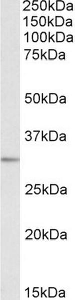 MAPRE3 Polyclonal Antibody