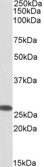 CHCHD3 Antibody in Western Blot (WB)