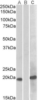 HOXA1 Polyclonal Antibody