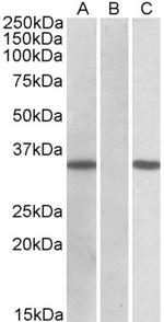 CRISP2 Polyclonal Antibody