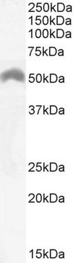 LSP1 Antibody in Western Blot (WB)