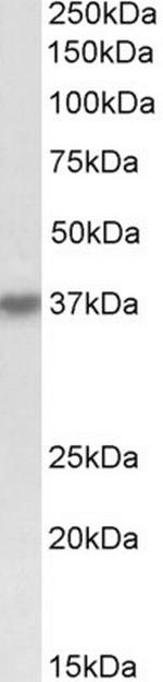 HSH2D Polyclonal Antibody