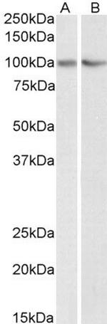 TRIM71 Antibody in Western Blot (WB)