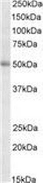 TRIP6 Polyclonal Antibody