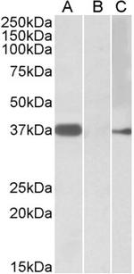 MYF6 Polyclonal Antibody