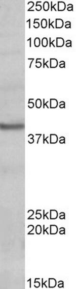 POU4F3 Polyclonal Antibody