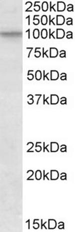Cullin 2 Antibody in Western Blot (WB)