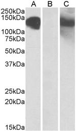 CDH11 Antibody in Western Blot (WB)