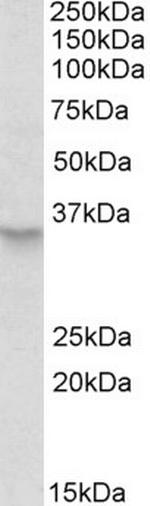 PEX2 Polyclonal Antibody