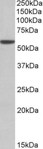 ALDH3A1 Antibody in Western Blot (WB)