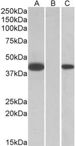 FANCF Polyclonal Antibody