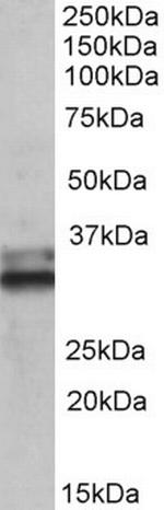 ETFA Antibody in Western Blot (WB)