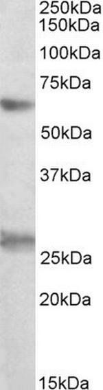 EIF2B4 Antibody in Western Blot (WB)