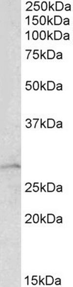 RhoGDI Polyclonal Antibody