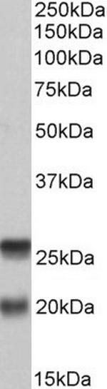 SNAP23 Antibody in Western Blot (WB)