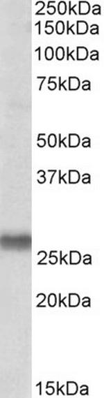 SNAP23 Antibody in Western Blot (WB)