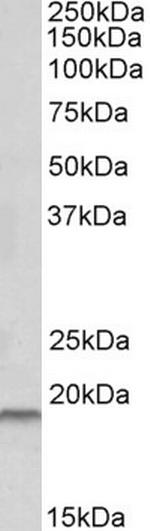 HAI-2 Antibody in Western Blot (WB)