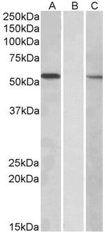 MGAT1 Polyclonal Antibody
