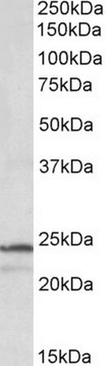 PSMB3 Antibody in Western Blot (WB)