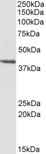 PSMB7 Polyclonal Antibody