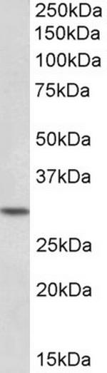 HOXC8 Antibody in Western Blot (WB)