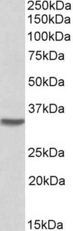 HOXC8 Antibody in Western Blot (WB)