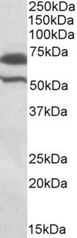cIAP2 Antibody in Western Blot (WB)