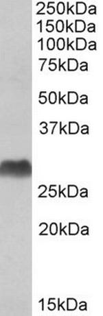 HLA-DQA1/DQA2 Polyclonal Antibody