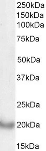 Dynactin 3 Antibody in Western Blot (WB)