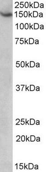 AGTPBP1 Polyclonal Antibody