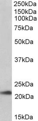 TMEM205 Antibody in Western Blot (WB)
