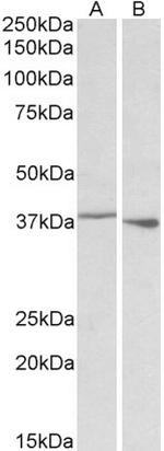 PCBP1 Polyclonal Antibody
