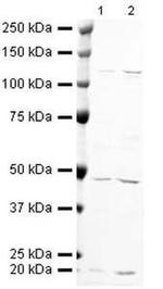 BAF53A Polyclonal Antibody
