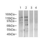 NSD3 Antibody in Western Blot (WB)