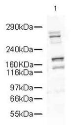 DcR1 Antibody in Western Blot (WB)