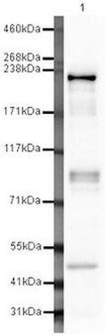 Dicer Antibody in Western Blot (WB)