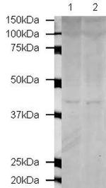 MBD3 Antibody in Western Blot (WB)