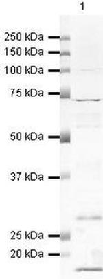 SPHK1 Antibody in Western Blot (WB)