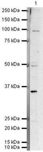 HIF-2 alpha Antibody in Western Blot (WB)