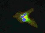 TSC1 Antibody in Immunocytochemistry (ICC/IF)