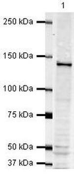 TSC1 Antibody in Western Blot (WB)