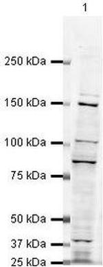 SMARCC1 Antibody in Western Blot (WB)