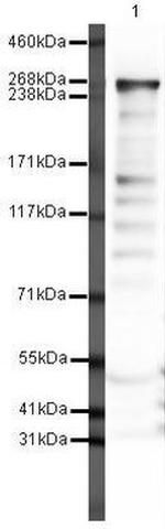 FASN Polyclonal Antibody