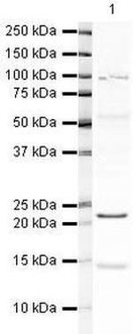 Hippocalcin Antibody in Western Blot (WB)
