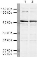 DDX17 Polyclonal Antibody