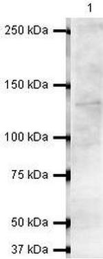 RNF40 Antibody in Western Blot (WB)