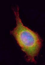 UBC9 Antibody in Immunocytochemistry (ICC/IF)