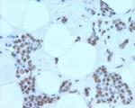 MRE11 Antibody in Immunohistochemistry (IHC)