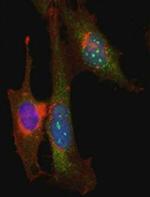 ITCH / AIP4 Antibody in Immunocytochemistry (ICC/IF)