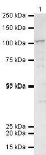 ITCH / AIP4 Antibody in Western Blot (WB)